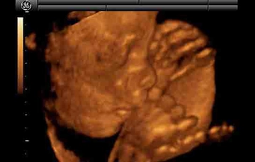 26 Haftalık Gebelikte Annede ve Bebekte Yaşanan Değişimler