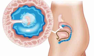 5 Haftalık Gebelikte Annede ve Bebekte Yaşanan Değişimler
